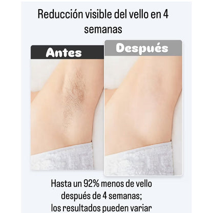 💖 Depilación Láser AMOTAOS IPL